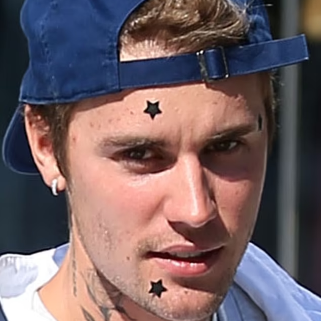 Les patchs anti acné colorés : la tendance beauté venue des États-Unis !