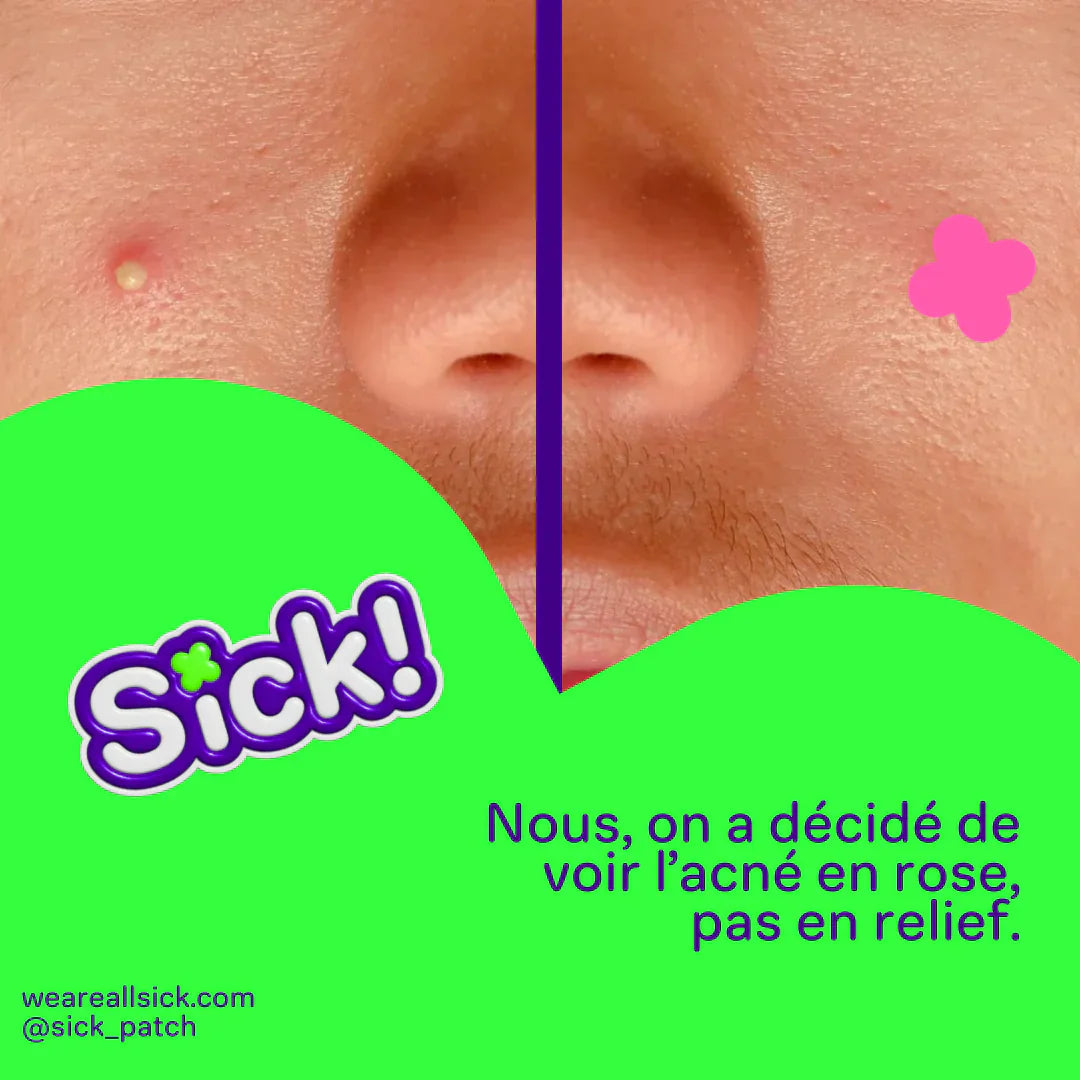 avant apres avec les patchs Sick!