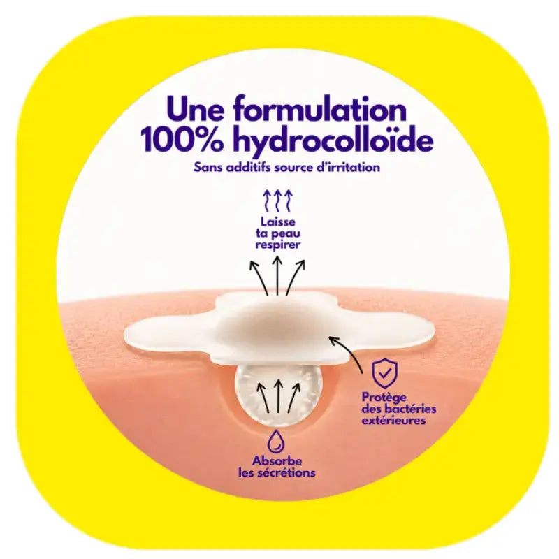 Patchs boutons 4 couleurs