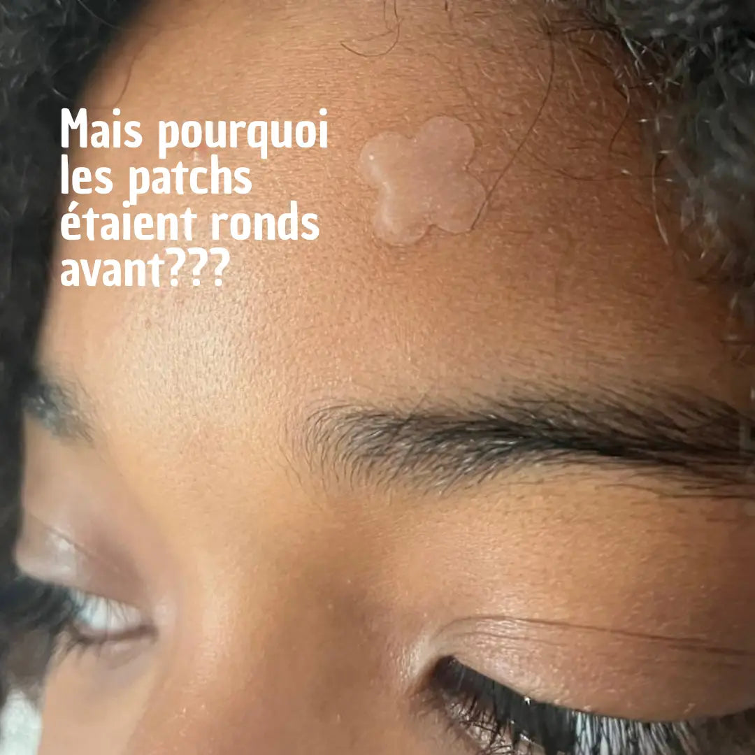 Nouveau Patch anti boutons transparent Clear Sick!